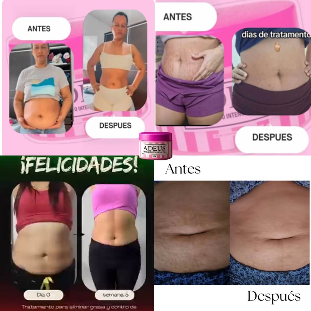 CREMA ADEUS® ORIGINAL. COMBATE ESTRIAS, FLACIDEZ Y CELULITIS YA.
